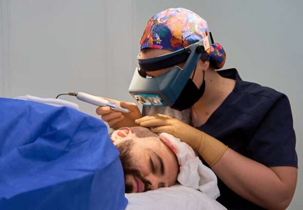 Hair Transplant
