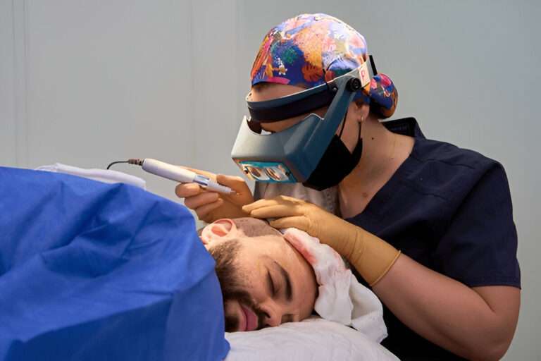Hair Transplant